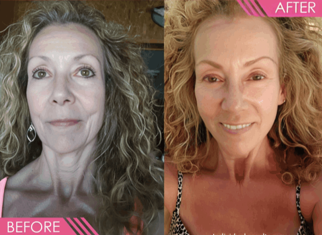 Vibriance Super C Serum customer-Brenda T.,  Arizona,  USA